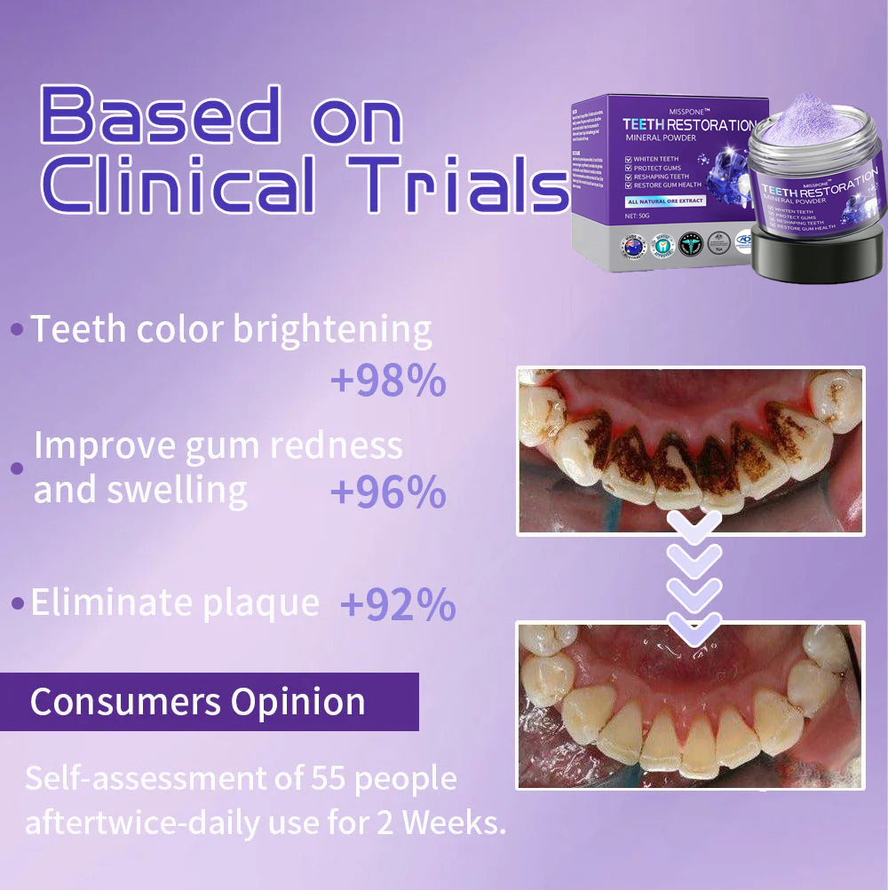 MISSPONE® Teeth Restoration Mineral Powder