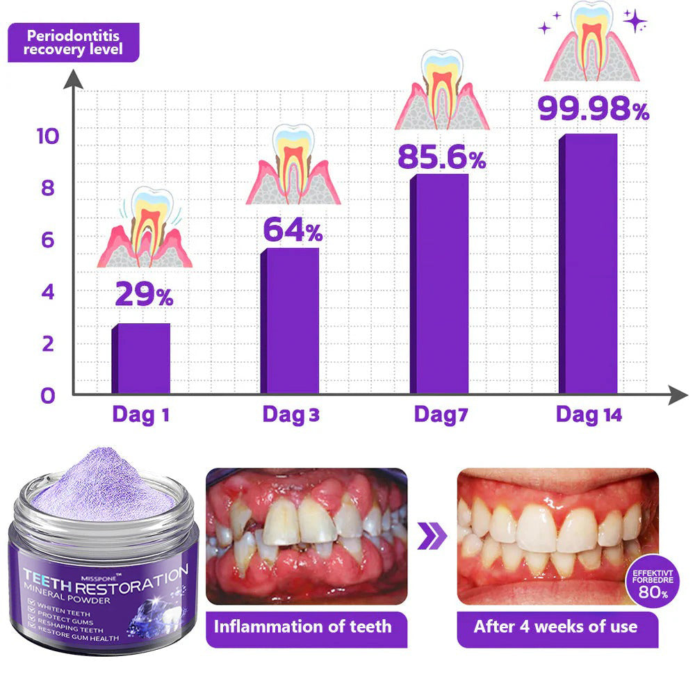 MISSPONE® Teeth Restoration Mineral Powder