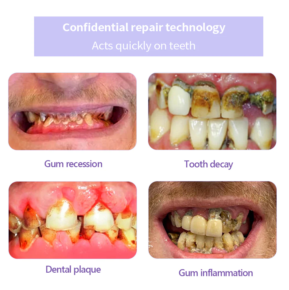 MISSPONE® Teeth Restoration Mineral Powder