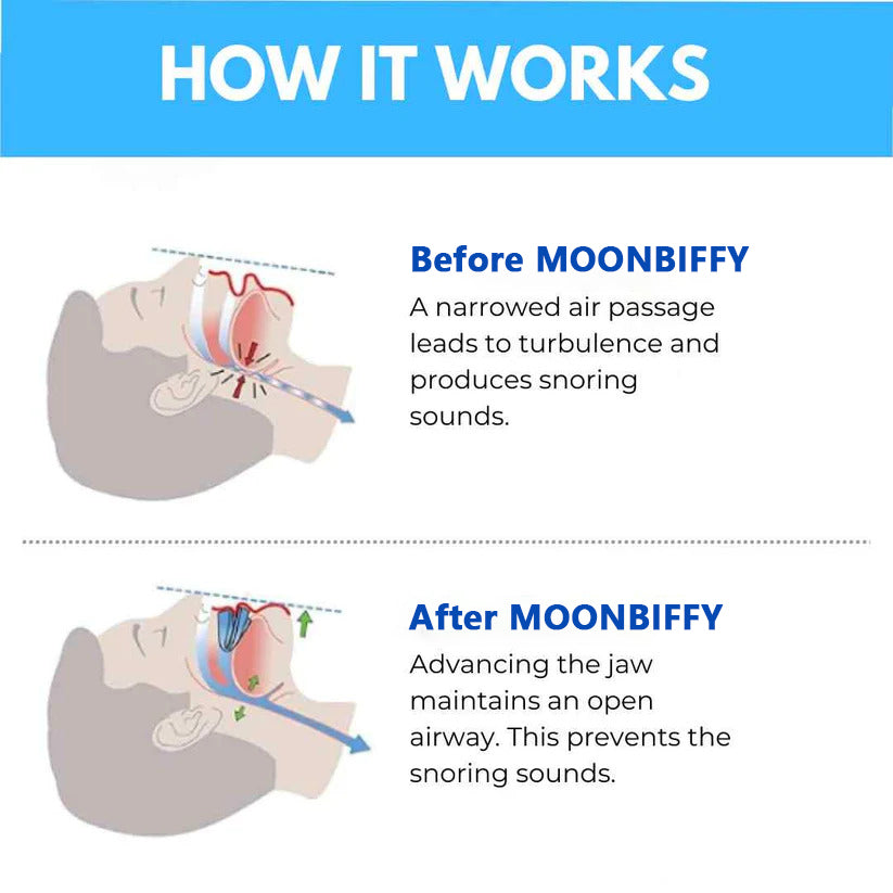 MOONBIFFY™ ANTI SNORING MOUTHPIECE