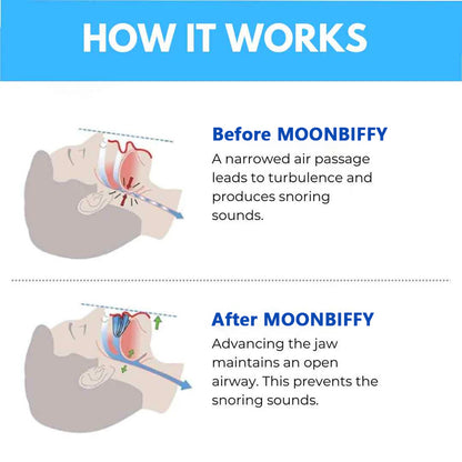 MOONBIFFY™ ANTI SNORING MOUTHPIECE