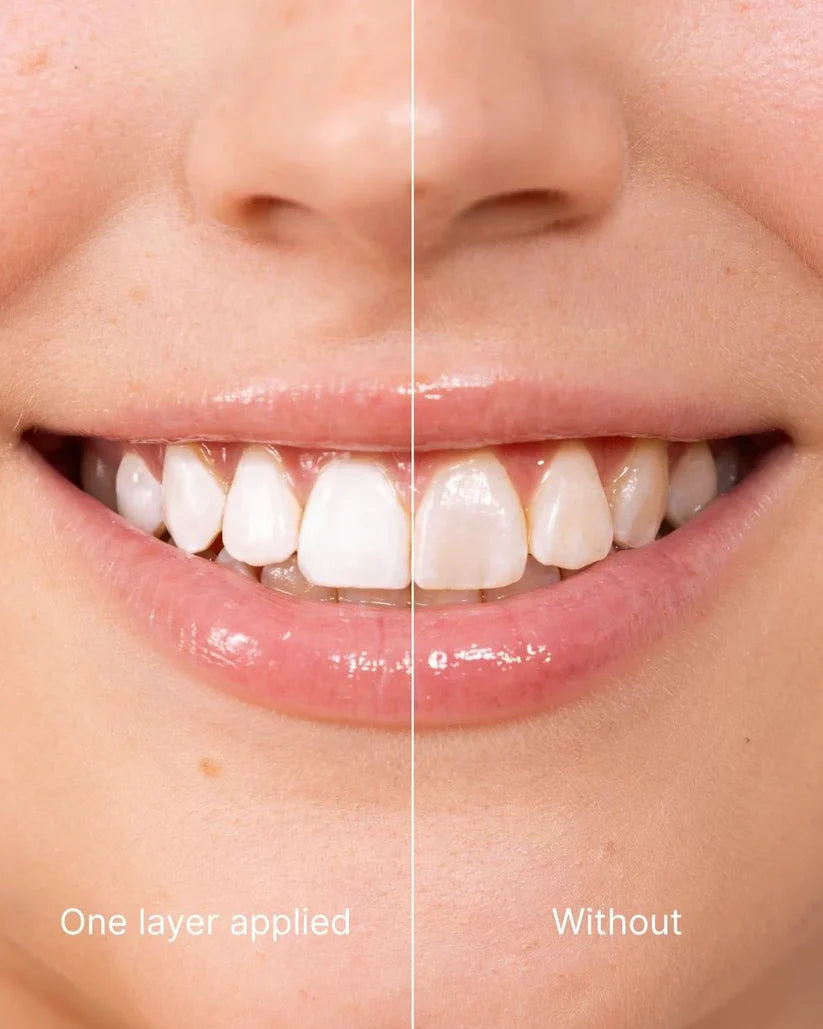 SmileFitPro™ Tooth Polish