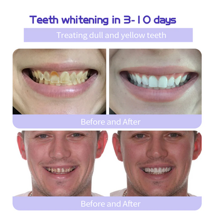 MISSPONE® Teeth Restoration Mineral Powder